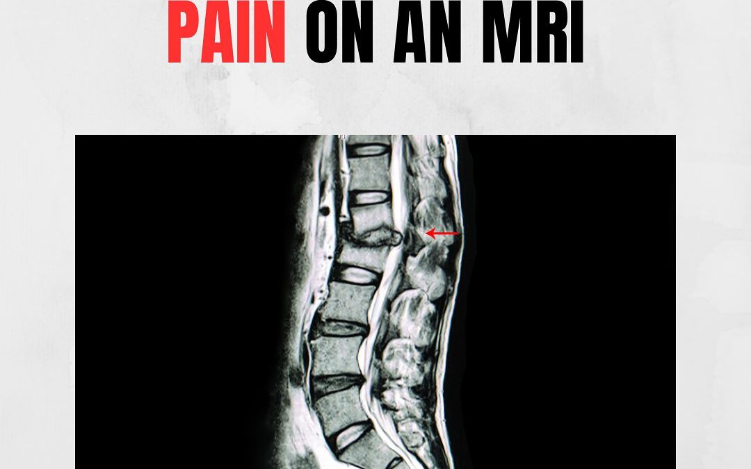 Pain – scan a tool for diagnosis